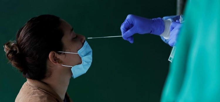 Min. Salute - Circ. 29/09/2020 n. 31400 - Uso dei test antigenici rapidi per la diagnosi di infezione da SARS -CoV-2